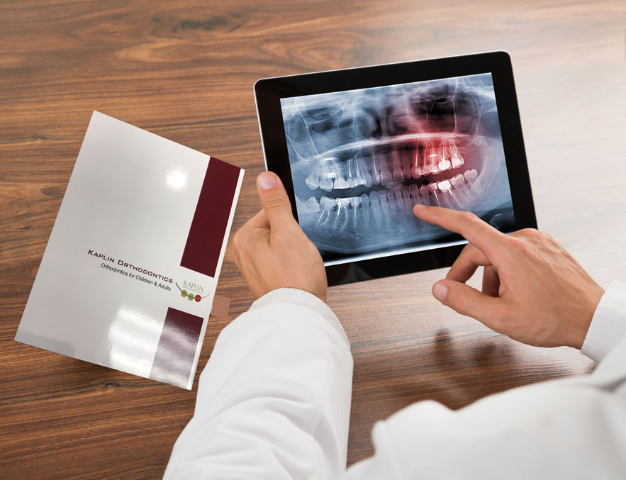 Top orthodontist Arlington Heights |palatine orthodontist |buffalo grove orthodontist